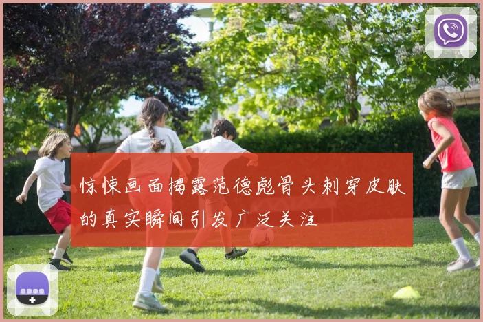 惊悚画面揭露范德彪骨头刺穿皮肤的真实瞬间引发广泛关注
